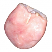 Fournisseur Bladder